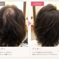 40代女性の分け目とトップのボリュームの変化を比較したビフォーアフター写真