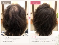 40代女性の分け目とトップのボリュームの変化を比較したビフォーアフター写真