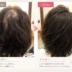 40代女性の分け目とトップのボリュームの変化を比較したビフォーアフター写真