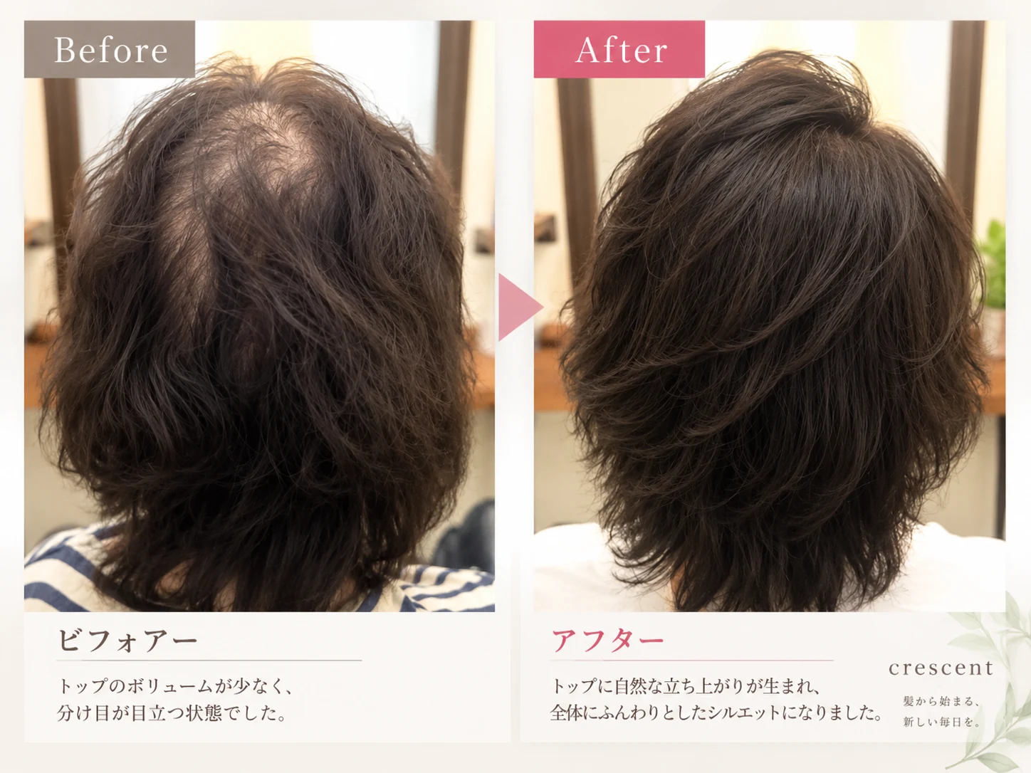分け目とトップのボリュームの変化を比較したビフォーアフター写真