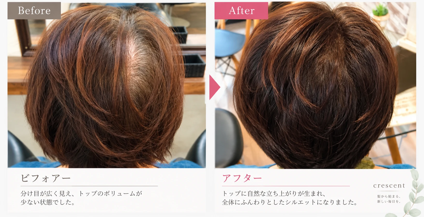 分け目の見え方とトップの立ち上がりを比較したビフォーアフター写真