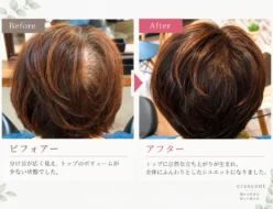 分け目とトップのボリュームが自然に整った女性の髪のBefore／After